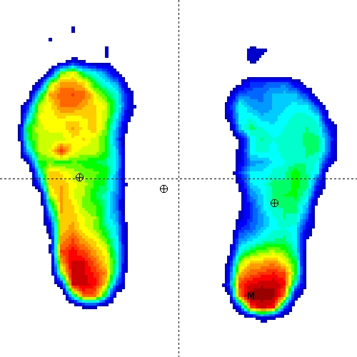 Foot