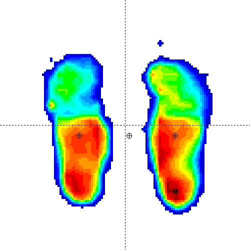 Foot