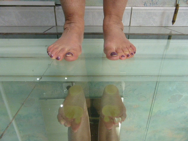 Pronation