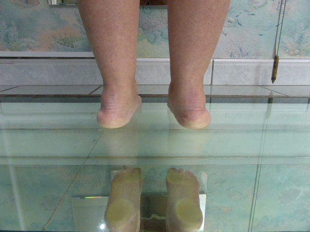 Pronation